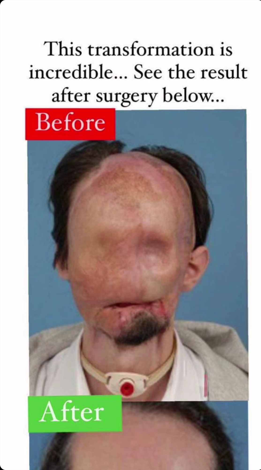 This transformation is incredible… See the result after surgery below…