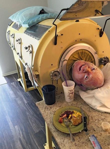 76-year-old man, paralyzed from polio at 6, is one of the last people with an iron lung: ‘My life is incredible’